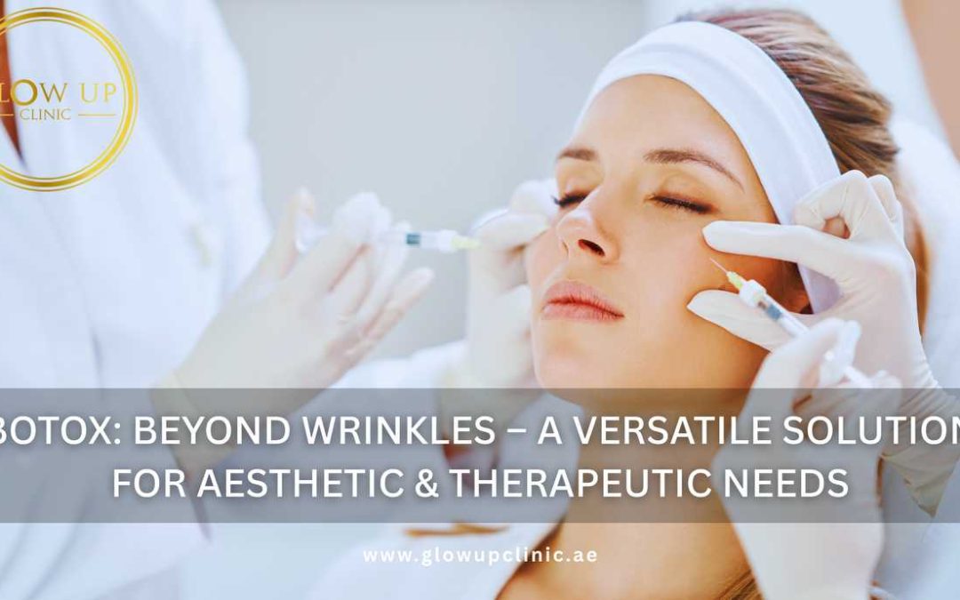 Botox Beyond Wrinkles – A Versatile Solution for Aesthetic & Therapeutic Needs
