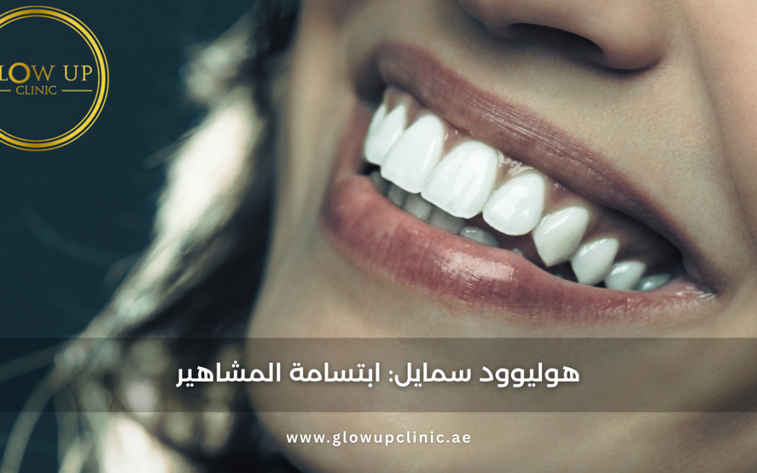 هوليوود سمايل: ابتسامة المشاهير