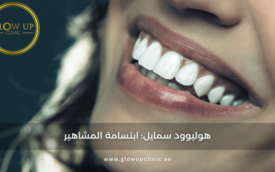 هوليوود سمايل: ابتسامة المشاهير