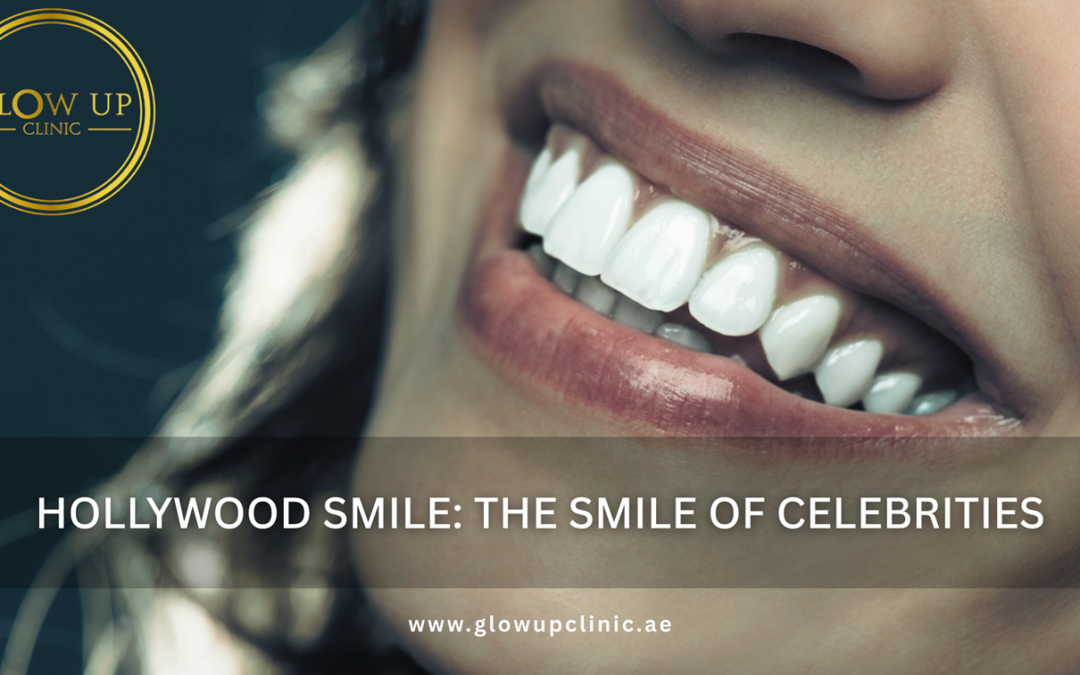 Hollywood Smile: The Smile of Celebrities