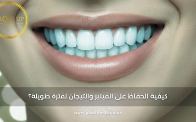 كيفية الحفاظ على الفينير والتيجان لفترة طويلة؟