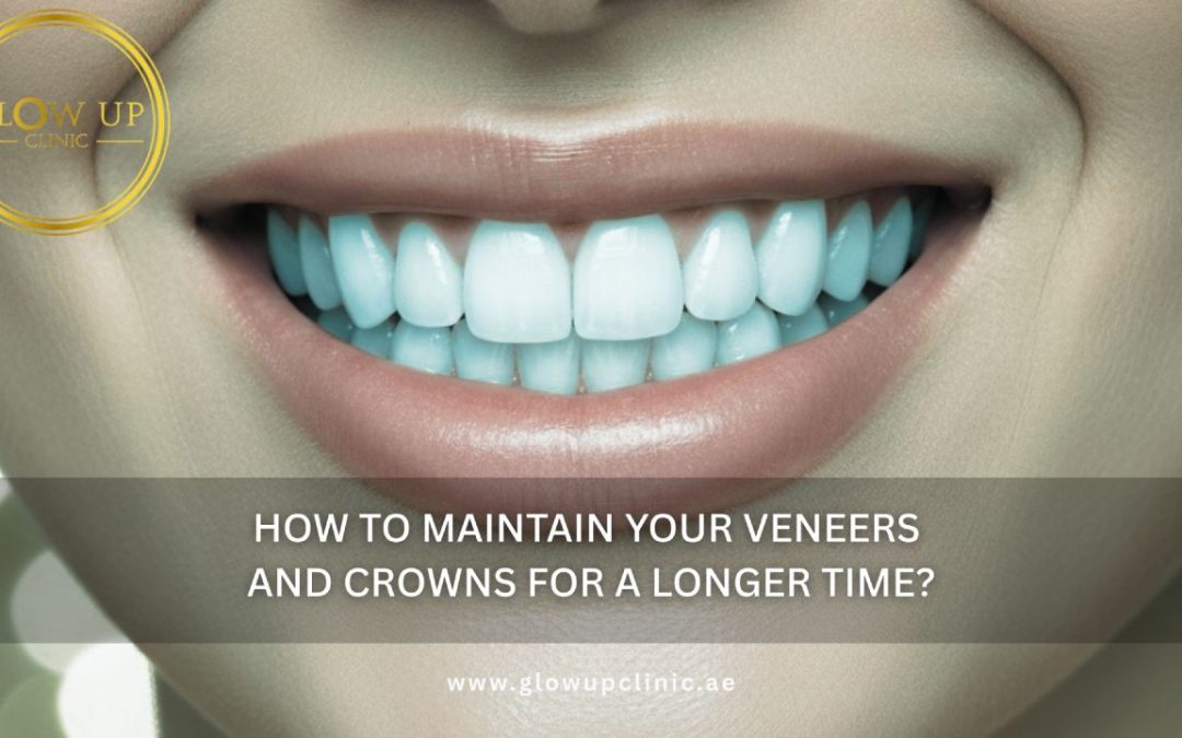 How to Maintain Your Veneers and Crowns for a Longer Time?