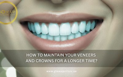 How to Maintain Your Veneers and Crowns for a Longer Time?