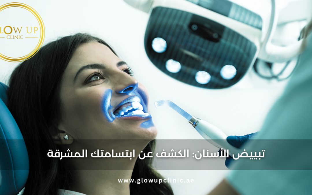 تبييض الأسنان: الكشف عن ابتسامتك المشرقة