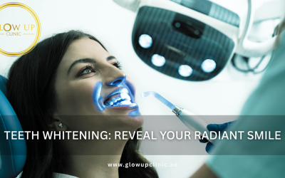 Teeth Whitening: Reveal Your Radiant Smile