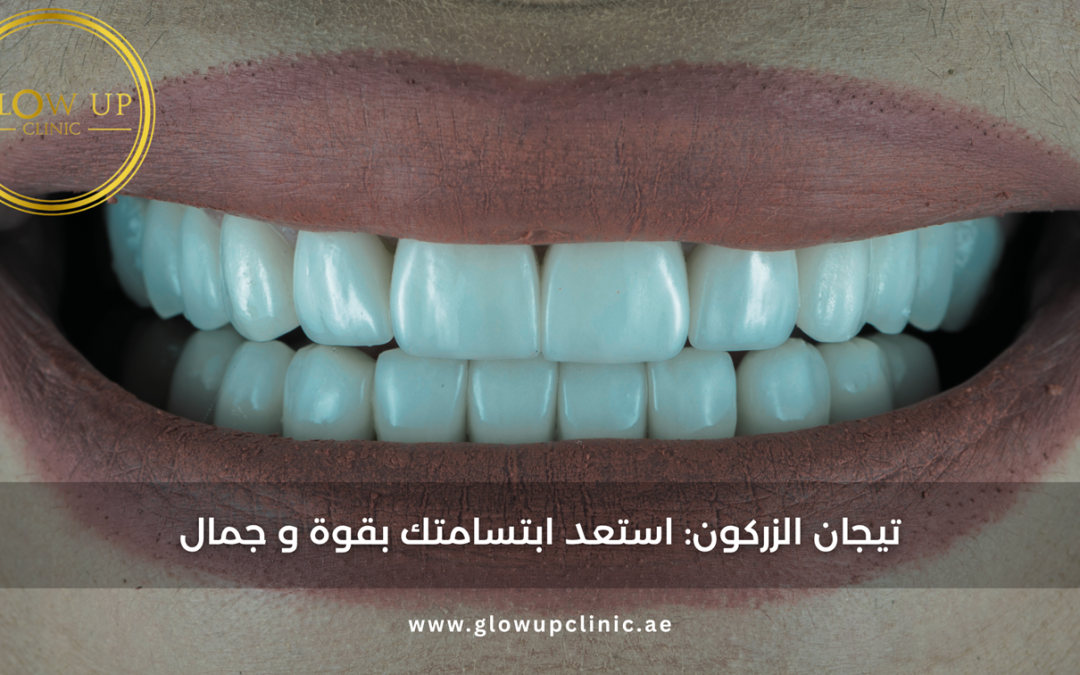 تيجان الزركون: استعد ابتسامتك بقوة و جمال