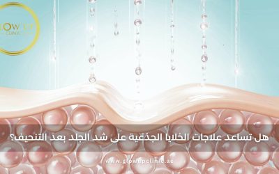 هل تساعد علاجات الخلايا الجذعية على شد الجلد بعد التنحيف؟
