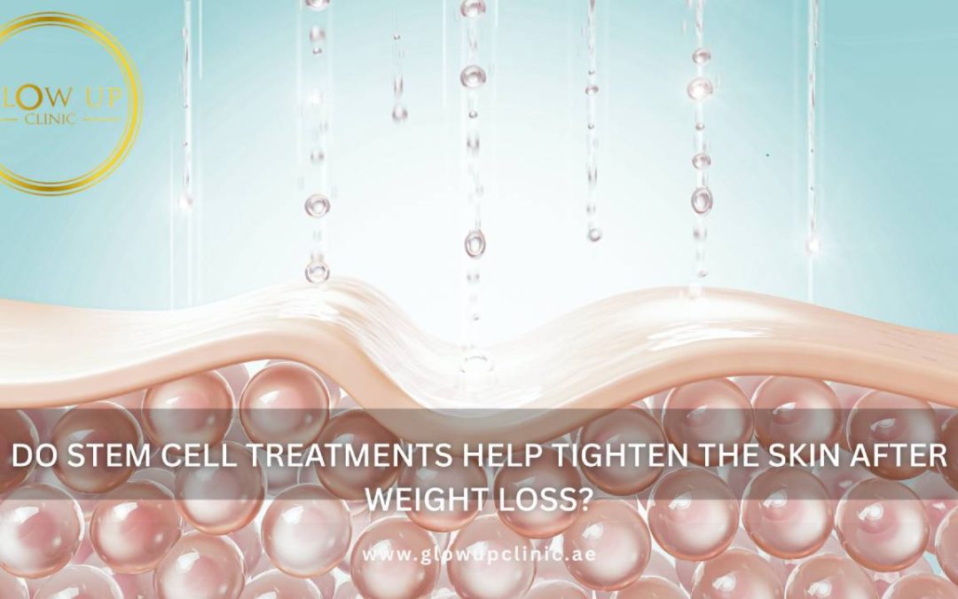 Do Stem Cell Treatments Help Tighten the Skin After Weight Loss
