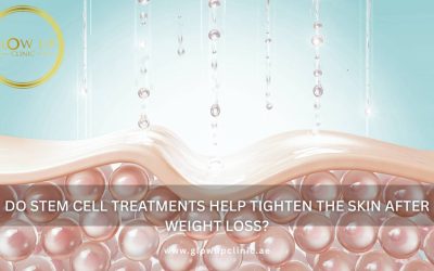 Do Stem Cell Treatments Help Tighten the Skin After Weight Loss