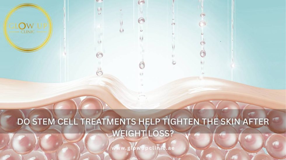 Do Stem Cell Treatments Help Tighten the Skin After Weight Loss? | Glow ...