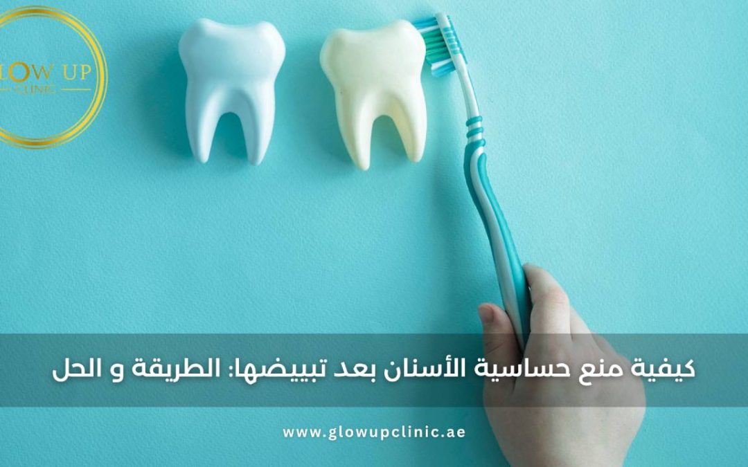 كيفية منع حساسية الأسنان بعد تبييضها: الطريقة والحل