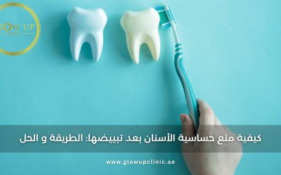 كيفية منع حساسية الأسنان بعد تبييضها: الطريقة والحل