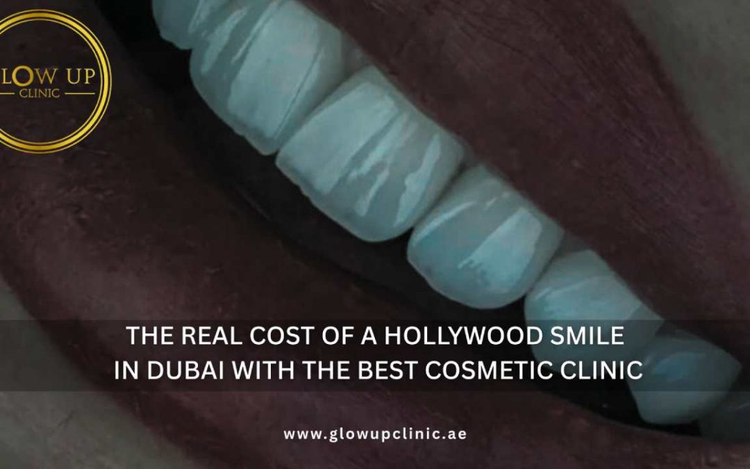 The Real Cost of a Hollywood Smile in Dubai with the Best Cosmetic Clinic