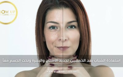 استعادة الشباب بعد الخمسين | تجديد الأسنان والبشرة ونحت الجسم معًا | عيادة جلو آب دبي