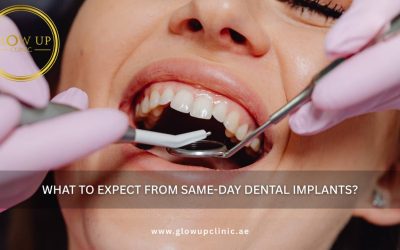 What to Expect from Same-Day Dental Implants?