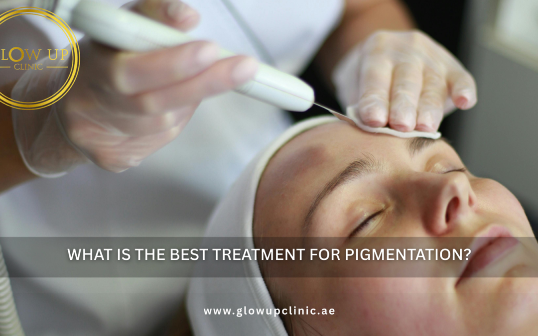 What Is the Best Treatment for Pigmentation?