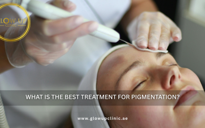 What Is the Best Treatment for Pigmentation?