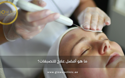 ما هو أفضل علاج للتصبغات؟