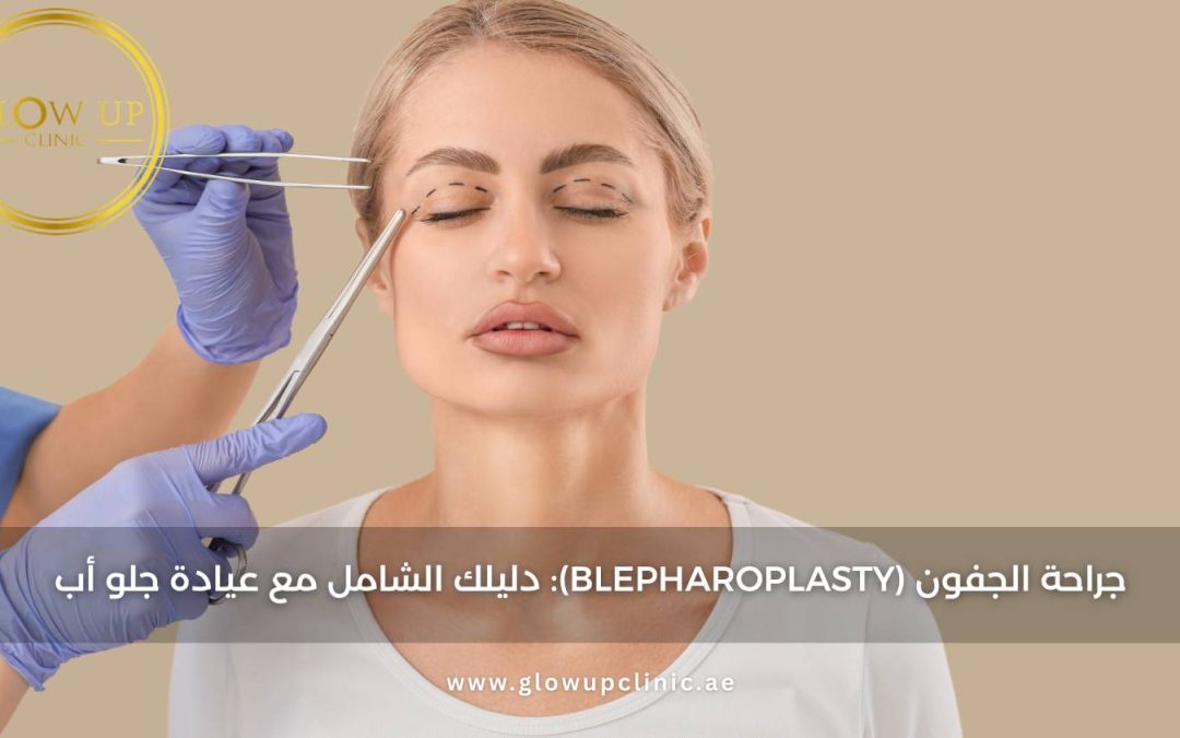 جراحة الجفون :دليلك الشامل مع عيادة جلو أب Blepharoplasty