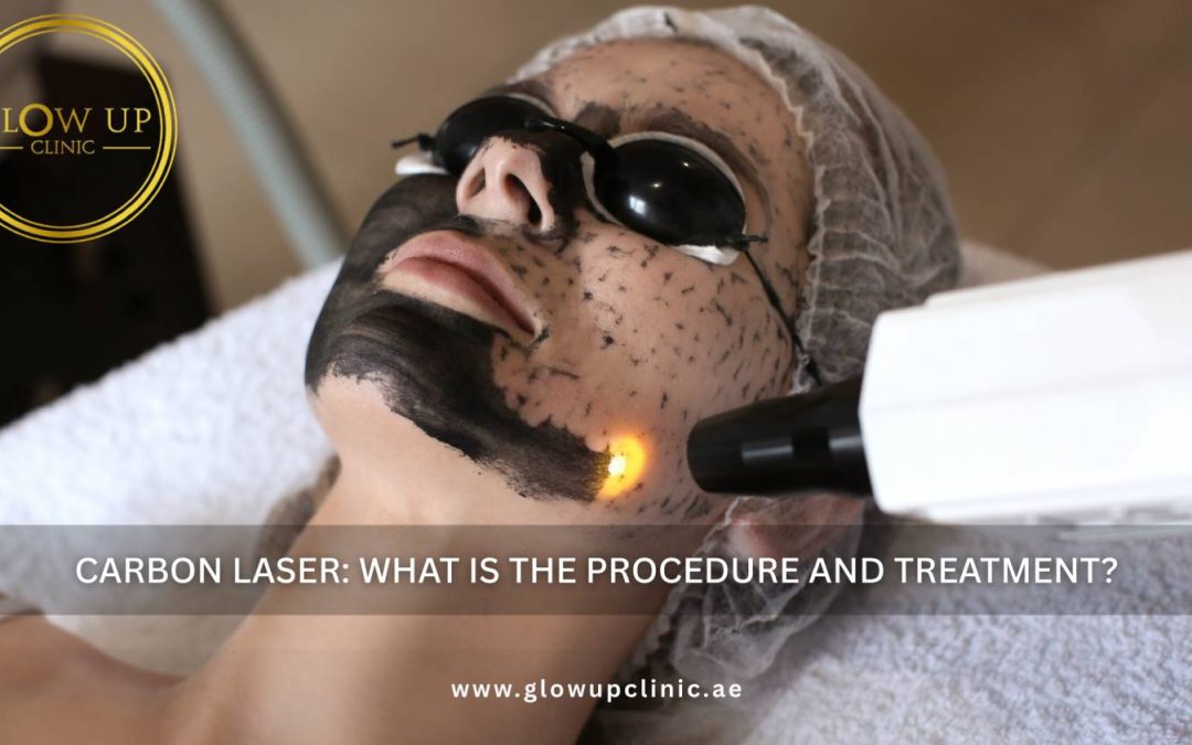Carbon Laser: What Is the Procedure and Treatment?