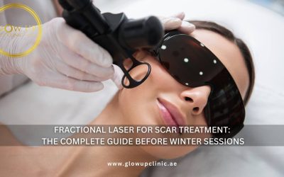 Fractional Laser for Scar Treatment: The Complete Guide