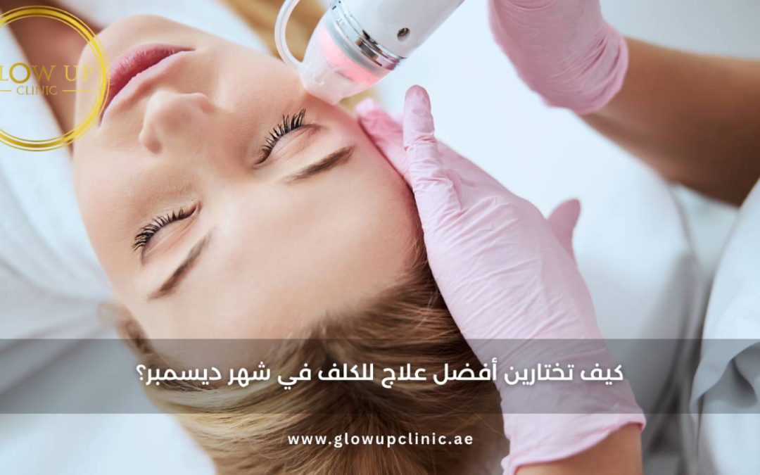 كيف تختارين أفضل علاج للكلف في شهر ديسمبر؟