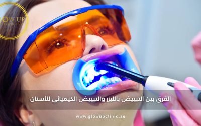 الفرق بين التبييض بالليزر والتبييض الكيميائي للأسنان