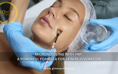 Microneedling with PRP A Powerful Formula for Skin Rejuvenation