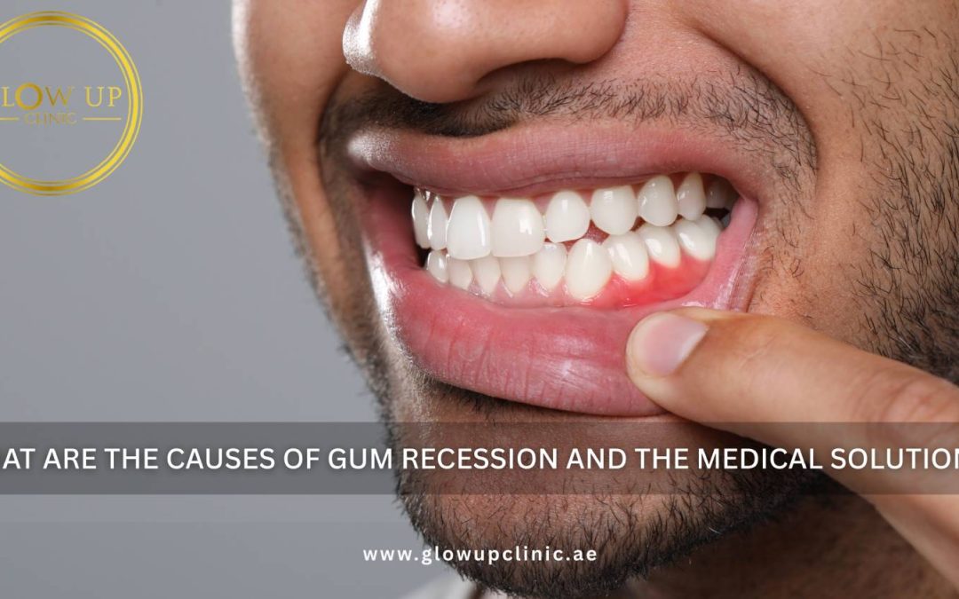 What Are the Causes of Gum Recession and the Medical Solutions