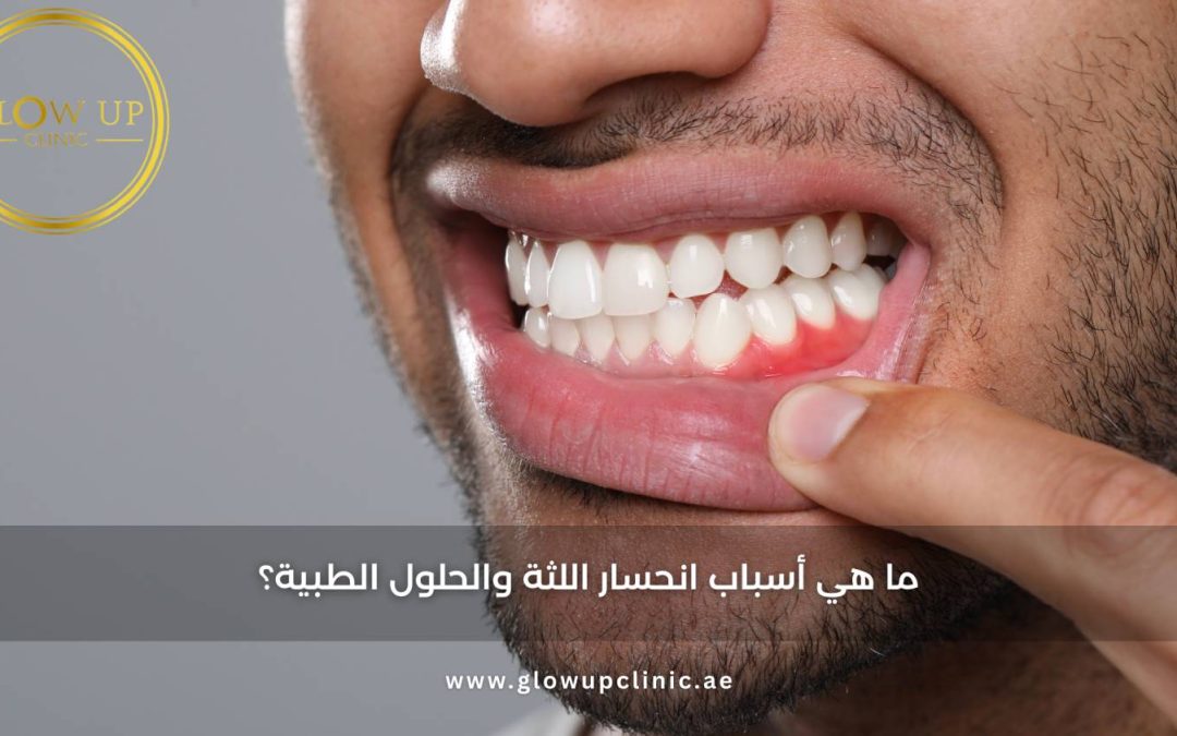 ما هي أسباب انحسار اللثة والحلول الطبية؟