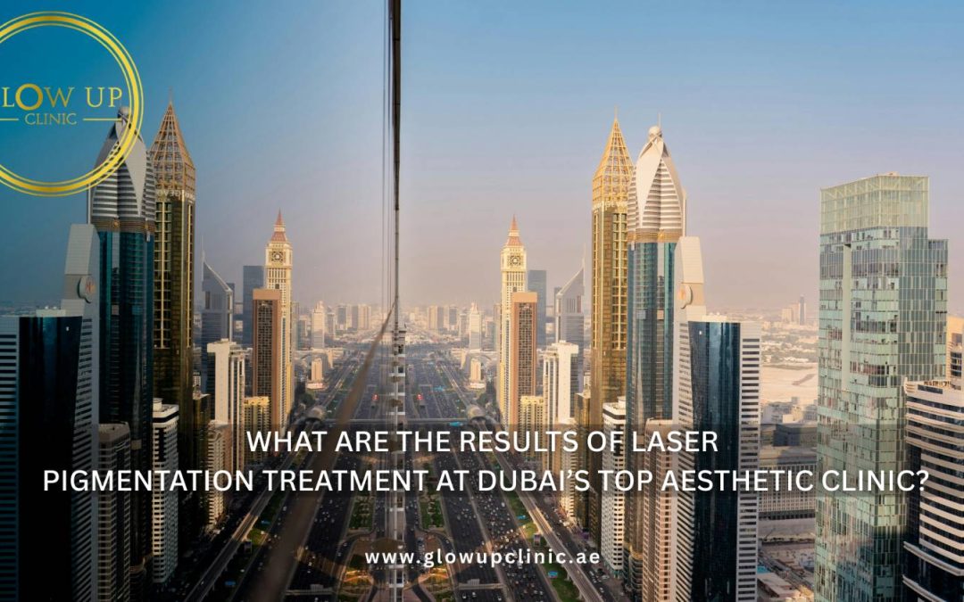 What Are the Results of Laser Pigmentation Treatment at Dubai’s Top Aesthetic Clinic