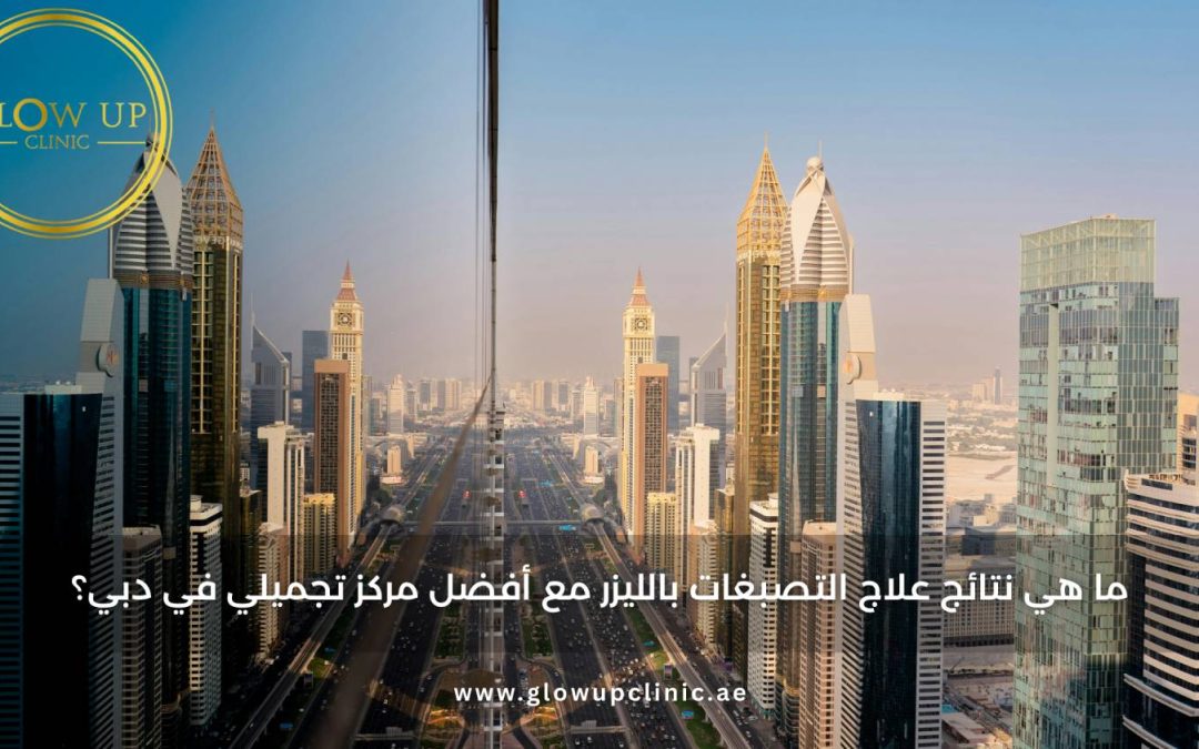ما هي نتائج علاج التصبغات بالليزر مع أفضل مركز تجميلي في دبي؟