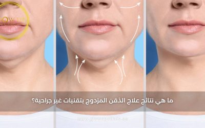 ما هي نتائج علاج الذقن المزدوج بتقنيات غير جراحية؟
