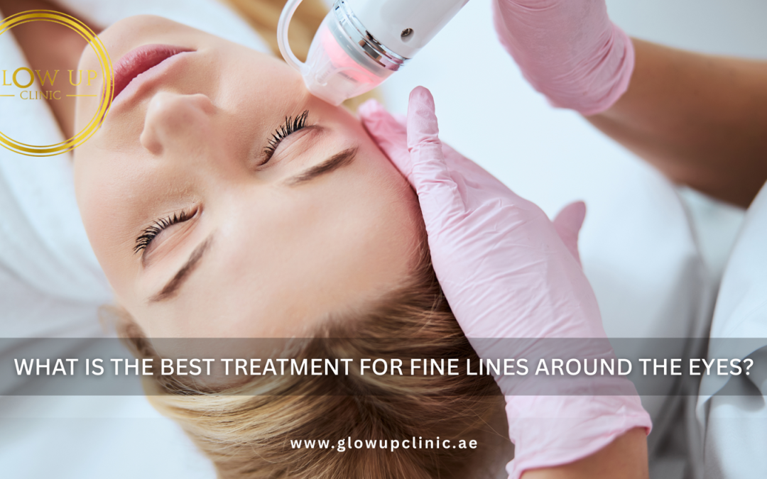What Is the Best Treatment for Fine Lines Around the Eyes