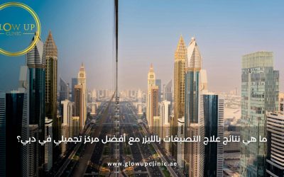 ما هو التقشير الأمثل قبل المناسبات وموسم حفلات نهاية السنة؟