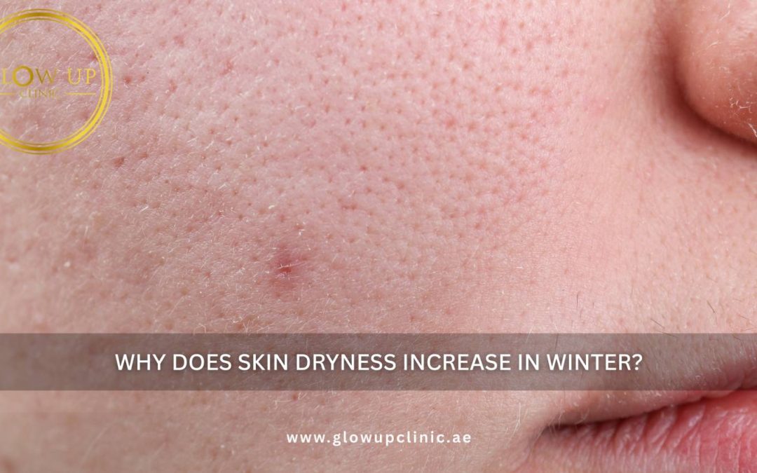 Why Does Skin Dryness Increase in Winter?