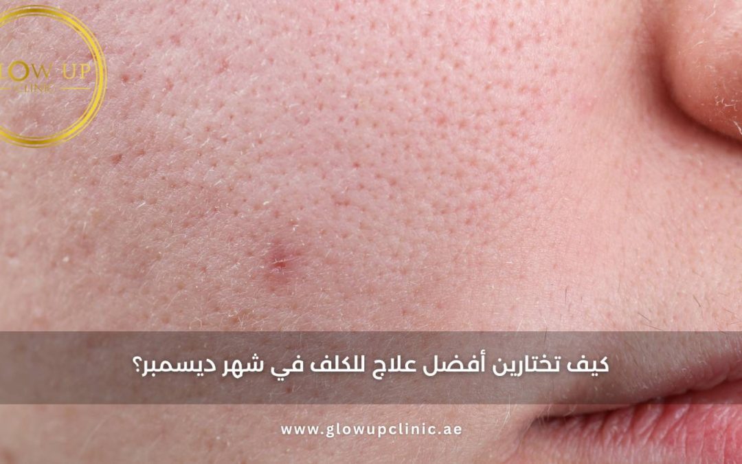 لماذا ترتفع مشاكل جفاف البشرة في الشتاء؟