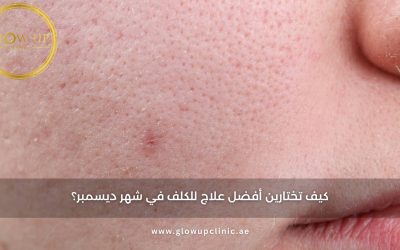 لماذا ترتفع مشاكل جفاف البشرة في الشتاء؟